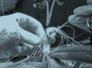 Cardiothoracic--Surgeon_2.3